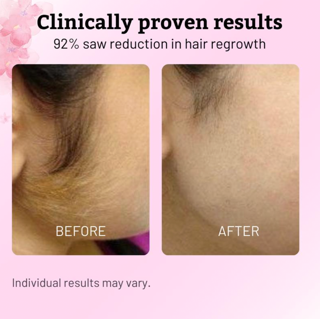 Oil for Natural Permanent Hair Reduction