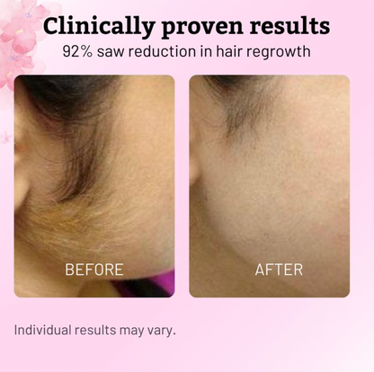 Oil for Natural Permanent Hair Reduction